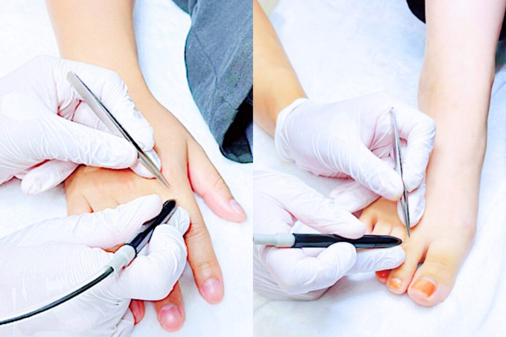 Private electrolysis hair removal salon in Kashiwa, Chiba, just 30 minutes from Tokyo, near Kashiwa Station