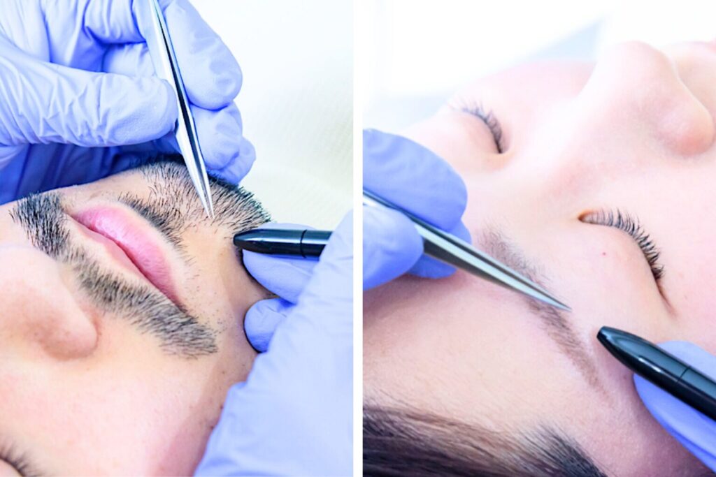 Permanent electrolysis hair removal at ReMove salon in Kashiwa, Chiba, Japan. top image