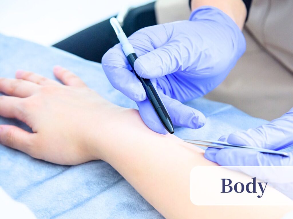 Permanent electrolysis hair removal at ReMove salon in Kashiwa, Chiba, Japan. top image