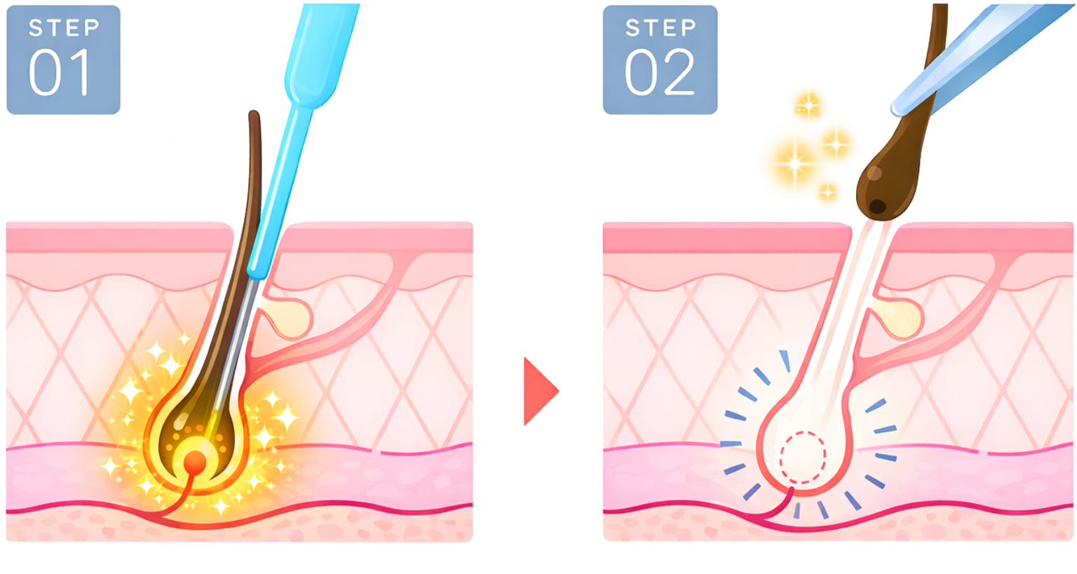 Private electrolysis hair removal salon in Kashiwa, Chiba, just 30 minutes from Tokyo, near Kashiwa Station