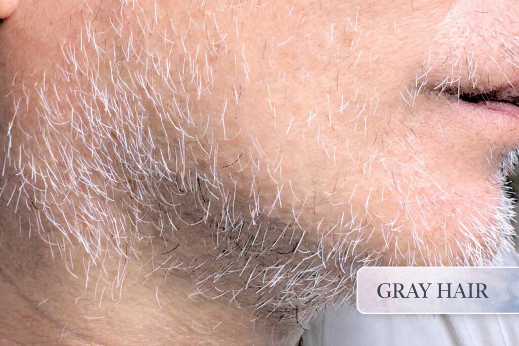 Private electrolysis hair removal salon in Kashiwa, Chiba, just 30 minutes from Tokyo, near Kashiwa Station